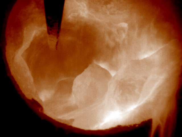 �\�����������\���D�G�Y�K�O��